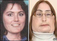 The two faces of Connie Culp